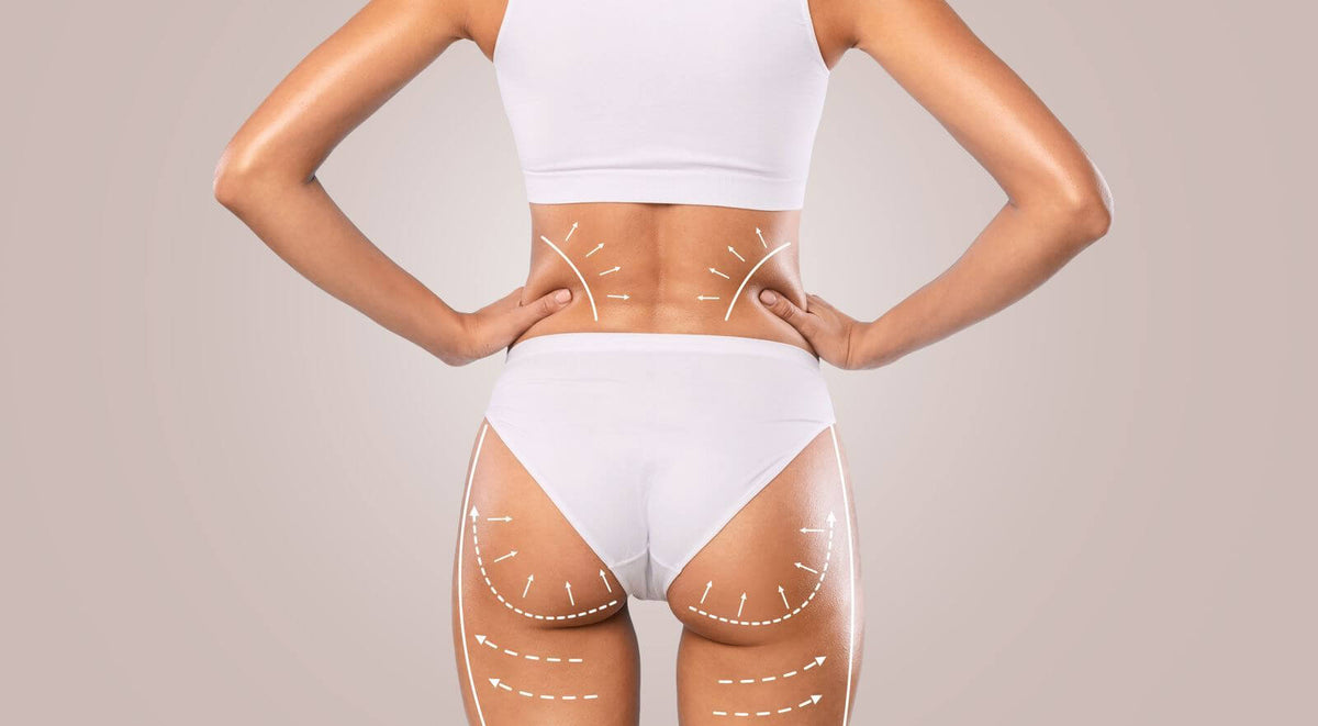 what-does-sculptra-butt-lift-mean-nexx-md